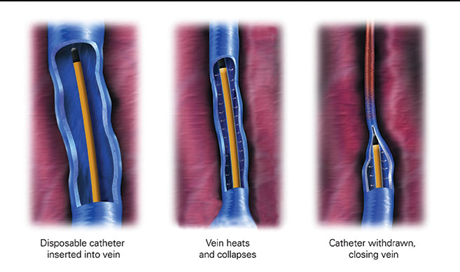 Treatment Options: Cardiac Cath Lab takes care of more than hearts